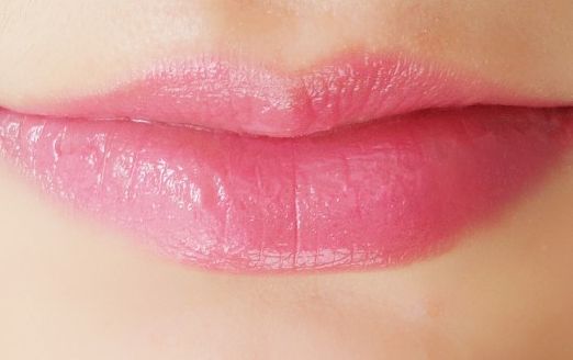 北京畫美醫(yī)院真實(shí)可靠嗎？親身吸脂歷程分享