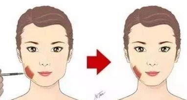 深圳整形圈熱門推薦！七位口碑高的假體豐臀醫(yī)生信息來襲！