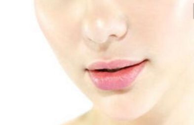 北京彤美醫(yī)療美容門診部侯舍予醫(yī)生手術效果評價及真實案例分析