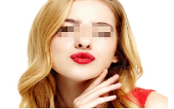 鄭州美萊枝蔓雙眼皮手術(shù)評價分享，價格公道有保障