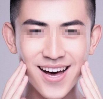 北京治疤痕手術(shù)哪家醫(yī)院好？