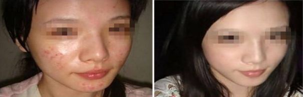 成都整形美容醫(yī)院排名揭曉，領(lǐng)先競(jìng)爭(zhēng)對(duì)手遠(yuǎn)遠(yuǎn)搶先！