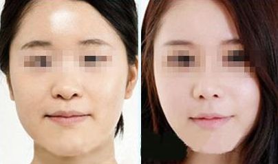 太原市很受歡迎的整形醫(yī)院排行榜