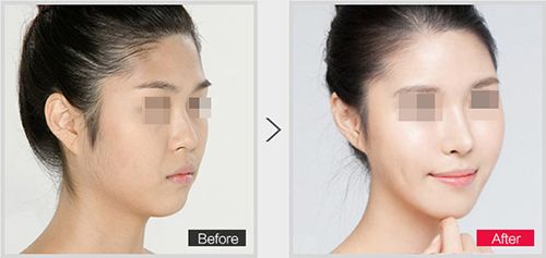 蘭州那家醫(yī)院能治療磨骨比較好？