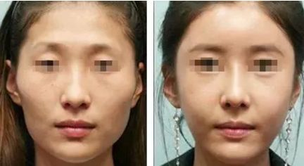 廣州有哪些知名整形醫(yī)院？