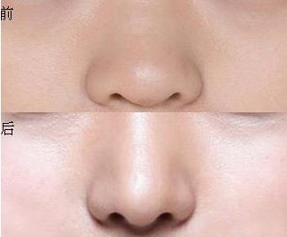 上海三甲整形醫(yī)院盤點！權(quán)威排行榜揭秘，實力在線！