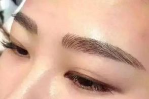 絕佳效果！體驗成都周維開刀雙眼皮的精彩案例