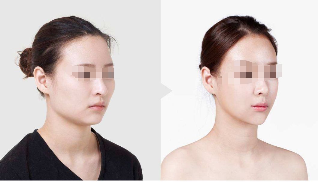 南寧哪家整形醫(yī)院可信度高