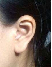 青島哪家整形醫(yī)院效果比較好？排名前三的華顏美堪稱翹楚！