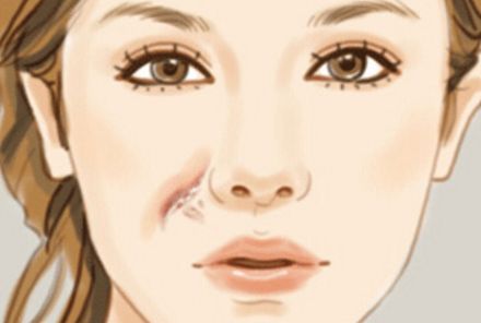 長沙亞韓醫(yī)院：專家親診！割雙眼皮價格解析和醫(yī)院簡介