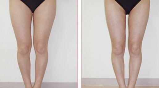 深圳市有哪些經(jīng)驗(yàn)豐富的脂肪填充醫(yī)生？Top五名單揭曉！