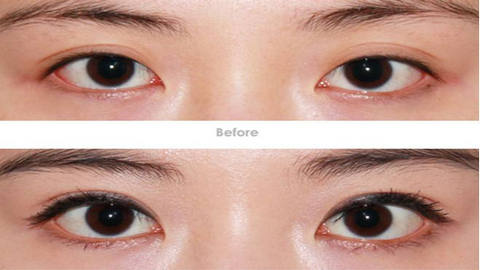 河南省中醫(yī)院整形科是吳盤紅、馬垟垟實力展示嗎？整形效果如何？