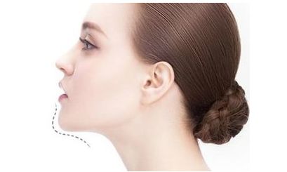 陸軍總院美容科：專家團(tuán)隊(duì)引領(lǐng)腰部吸脂，成功案例揭秘！