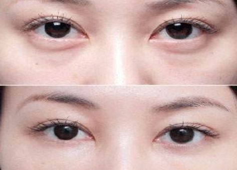 北京最受歡迎的整形醫(yī)院排名高居前三！私立醫(yī)美實力超越公立醫(yī)院！