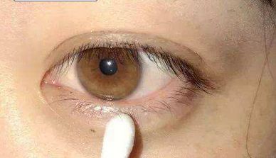 西京醫(yī)院：宋保強(qiáng)醫(yī)生主刀，隆胸手術(shù)安全可靠嗎？