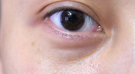 沈陽市精修胸部重塑診所排行榜，為您推薦備受好評(píng)的整形醫(yī)療機(jī)構(gòu)