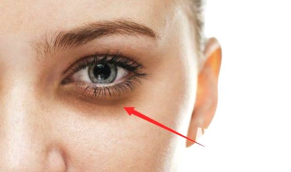 上海第一人民醫(yī)院整形科價格表——是這個夏天變美的理想選擇嗎？整形科去眼紋恢復(fù)效果如何呢？