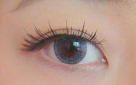 優(yōu)美雙眼輕松可得，了解樓善葉做雙眼皮的詳細(xì)過程和真實案例