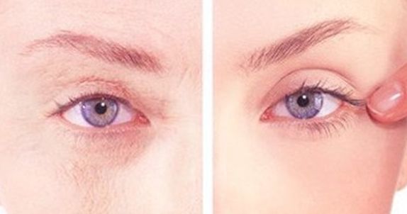 沈陽醫(yī)大二院美容整形科權(quán)威專家盛裝亮相，2023價格表曝光，丨真絕佳效果去眼袋案例讓人羨慕