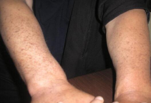 東菀膚康皮膚科醫(yī)院醫(yī)生資歷一覽——這家醫(yī)院的醫(yī)生們經(jīng)驗豐富嗎？是否專業(yè)可靠？