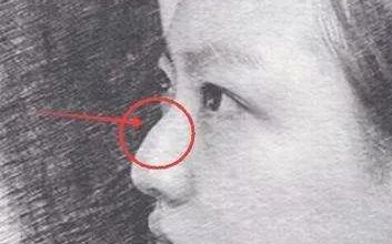 合肥雙眼皮整形醫(yī)院推薦：探尋當?shù)?家口碑佳的醫(yī)美機構(gòu)