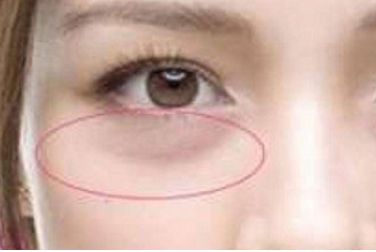 韓國(guó)優(yōu)質(zhì)整形醫(yī)院推薦，專業(yè)假體隆鼻術(shù)效果好