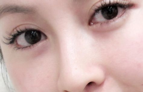 廣州熱瑪吉授權(quán)醫(yī)院有哪些好？