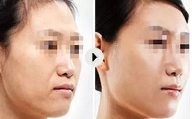 2024年大連優(yōu)質(zhì)整形醫(yī)院排行榜出爐，讓您輕松找到靠譜整形醫(yī)院