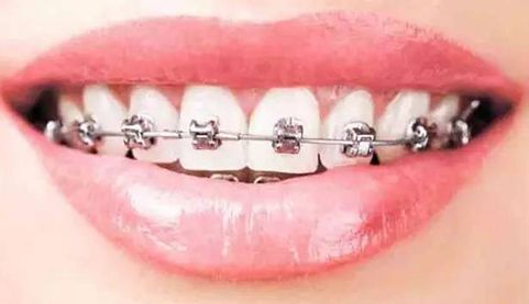 南京美容專家推薦：解決斑點(diǎn)問題的好去處！