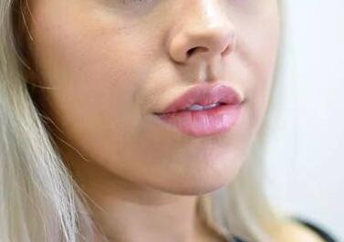 福建省第二人民醫(yī)院整形外科的技術(shù)水平如何？該醫(yī)院整形外科好不好？