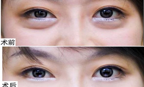 揭曉！鄭州2023年首屈一指的鼻部整形名醫(yī)TOP10震撼排行出爐