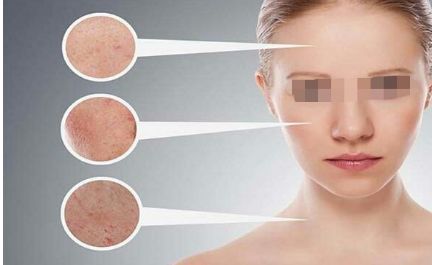 廣州熱拉提托拉斯哪間店靠譜