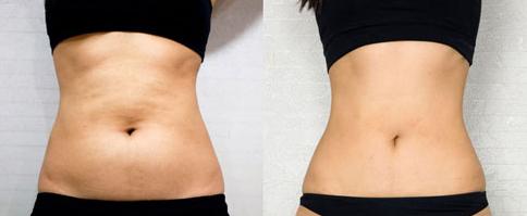 昆明魚美人醫(yī)療整形美容口碑好嗎？專業(yè)醫(yī)院介紹分享