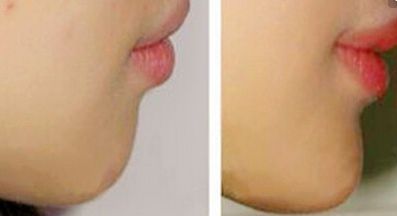 鄭州鼻部整形名醫(yī)盤點！權(quán)威醫(yī)生七人班底完美曝光