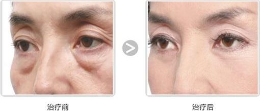 西安地區(qū)醫(yī)美整形醫(yī)院綜合排名匯總，強力醫(yī)療機構數(shù)據(jù)大公開