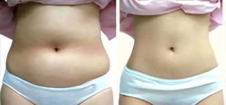 昆明市熱門植發(fā)醫(yī)院排行榜，公立私立都在內(nèi)，你值得擁有更好的選擇