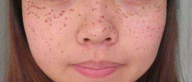 深度解析廣東萊美醫(yī)療美容醫(yī)院吸脂技術(shù)優(yōu)劣，費用詳細解讀