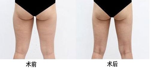 西安雙眼皮修復醫(yī)生榜單揭曉！頂級專家實力合集！