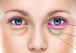 眼部整形北京，哪家醫(yī)院實力最強？三所醫(yī)院大比拼