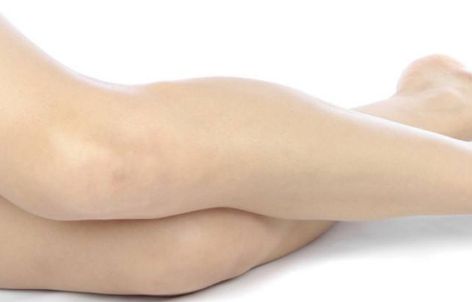 武漢華美李小丹醫(yī)生吸脂術(shù)的效果如何？案例公布供參考