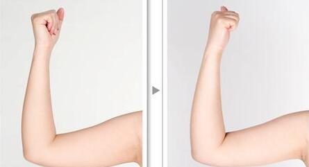 贛州市人民醫(yī)院美容整形科值得信賴嗎？2023價(jià)格表分享