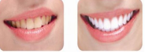 南昌哪家整形醫(yī)院的除皺手術(shù)比較好？前十實力醫(yī)院推薦!