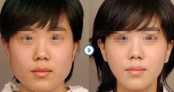 邯鄲梵星醫(yī)療美容：技術實力聚焦，項目擅長解讀，價格參考公開