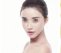 深圳哪家醫(yī)院能安全有效地進行隆鼻整形？