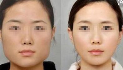 2024年鄭州市熱門整形醫(yī)院推薦，在排名前10中有哪些？