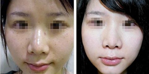 合肥哪幾家三甲整形醫(yī)院受歡迎？