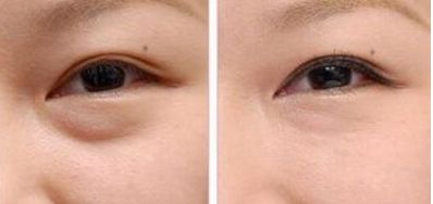 武漢愛思特整形醫(yī)院值得信賴嗎？專家團(tuán)隊(duì)丨磨骨案例丨最新報(bào)價(jià)