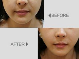 上海九院鼻部整形權(quán)威醫(yī)生曝光，李青峰、章一新上榜！