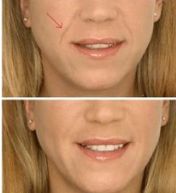 長(zhǎng)沙東宸醫(yī)療整容醫(yī)生推薦技術(shù)成果展現(xiàn)，費(fèi)用參考來啦！