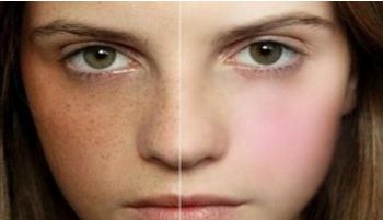 北京哪里做正頜手術(shù)好？這幾家醫(yī)院被口碑推崇